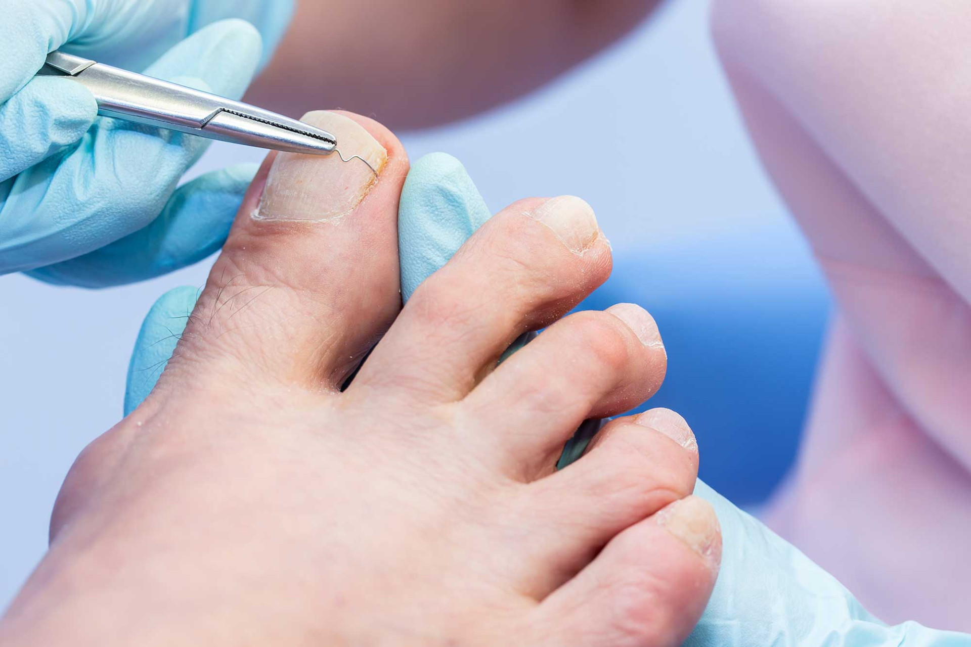 Fachinstitut für Nagelkorrektur - Kosmetik & Podologie M. Klöpper in Hannover